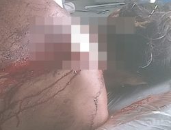 Ngeri! Cari Kepiting, Pemuda Ini Malah Disabet dengan Parang