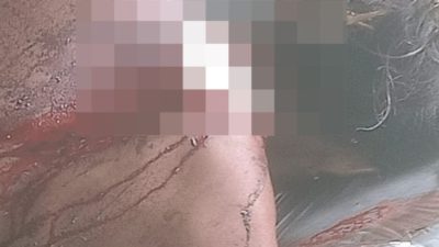 Ngeri! Cari Kepiting, Pemuda Ini Malah Disabet dengan Parang